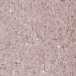 MEGF8 Antibody, Novus Biologicals 0.1mL; Unlabeled:Antibodies, Polyclonal